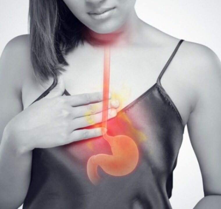 γαστοοισοφαγική παλινδρόμηση ιατρικά Κατσούλας katsoulas.eu